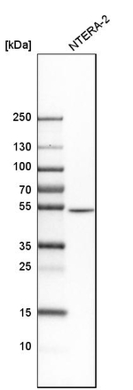 Septin-7 Antibody in Western Blot (WB)