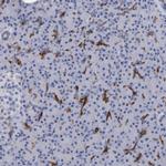 SLC28A3 Polyclonal Antibody