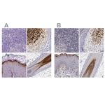 GSDMA Polyclonal Antibody