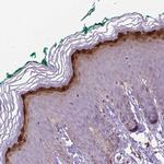 GSDMA Antibody in Immunohistochemistry (IHC)