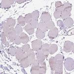 GSDMA Antibody in Immunohistochemistry (IHC)