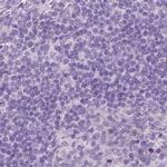 GSDMA Antibody in Immunohistochemistry (IHC)