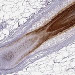 GSDMA Antibody in Immunohistochemistry (IHC)