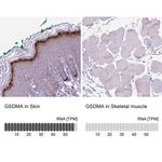 GSDMA Antibody