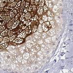 GSDMA Antibody in Immunohistochemistry (IHC)