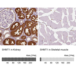 SHMT1 Antibody in Immunohistochemistry (Paraffin) (IHC (P))