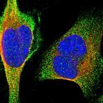 MARCH10 Polyclonal Antibody