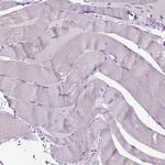 MARCH10 Antibody in Immunohistochemistry (Paraffin) (IHC (P))