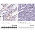 MARCH10 Antibody in Immunohistochemistry (IHC)