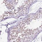 MARCH10 Antibody in Immunohistochemistry (IHC)