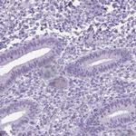 MARCH10 Antibody in Immunohistochemistry (IHC)