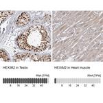 HEXIM2 Antibody in Immunohistochemistry (IHC)