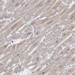 HEXIM2 Antibody in Immunohistochemistry (IHC)