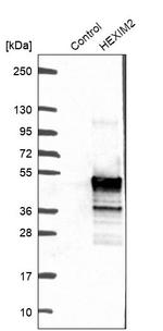 HEXIM2 Antibody in Western Blot (WB)