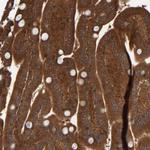 CCDC57 Polyclonal Antibody