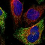 ATPAF2 Polyclonal Antibody