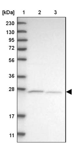 ATPAF2 Antibody in Western Blot (WB)