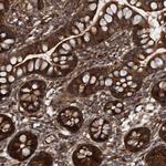 Cdc42EP4 Antibody in Immunohistochemistry (Paraffin) (IHC (P))