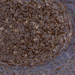 Cdc42EP4 Antibody in Immunohistochemistry (Paraffin) (IHC (P))