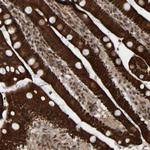 CCDC57 Polyclonal Antibody