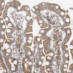 CCDC57 Antibody in Immunohistochemistry (IHC)