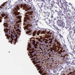 ZFP2 Polyclonal Antibody