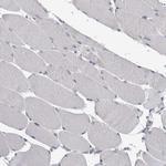 FAM83G Antibody in Immunohistochemistry (Paraffin) (IHC (P))