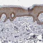 FAM83G Antibody in Immunohistochemistry (Paraffin) (IHC (P))