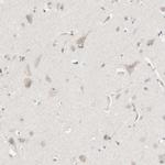 PCM1 Antibody in Immunohistochemistry (IHC)