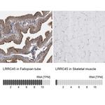 LRRC45 Antibody in Immunohistochemistry (IHC)