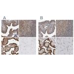 LRRC45 Antibody in Immunohistochemistry (IHC)