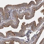 LRRC45 Antibody in Immunohistochemistry (IHC)