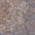 LRRC45 Antibody in Immunohistochemistry (IHC)