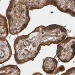 LRRC45 Antibody in Immunohistochemistry (IHC)