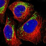 MRPL45 Polyclonal Antibody