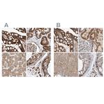MRPL45 Antibody in Immunohistochemistry (IHC)