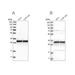 MRPL45 Antibody in Western Blot (WB)