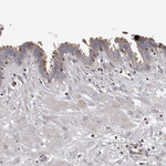 PCM1 Antibody in Immunohistochemistry (Paraffin) (IHC (P))