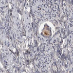 PCM1 Antibody in Immunohistochemistry (Paraffin) (IHC (P))