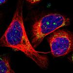 HEXDC Polyclonal Antibody