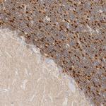 HEXDC Antibody in Immunohistochemistry (Paraffin) (IHC (P))