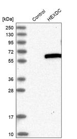 HEXDC Antibody in Western Blot (WB)