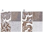 LRRC45 Polyclonal Antibody