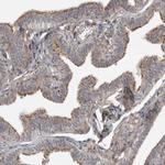 LRRC45 Antibody in Immunohistochemistry (IHC)