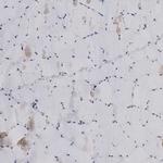 LRRC45 Antibody in Immunohistochemistry (IHC)