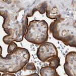 LRRC45 Antibody in Immunohistochemistry (IHC)