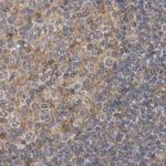 LRRC45 Antibody in Immunohistochemistry (IHC)