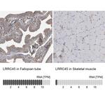LRRC45 Antibody