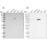 LRRC45 Antibody in Western Blot (WB)