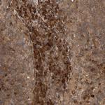 ZFAND1 Antibody in Immunohistochemistry (IHC)